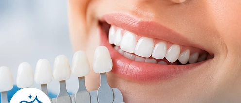 Teeth Whitening dental treatment image